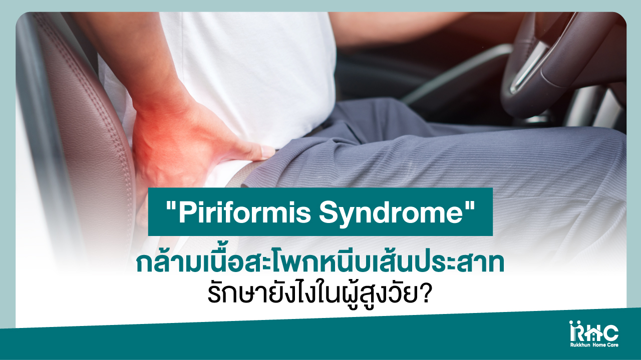 "Piriformis Syndrome" กล้ามเนื้อสะโพกหนีบเส้นประสาท รักษายังไงในผู้สูงวัย?